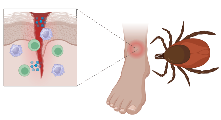 Initiation of an Inflammatory Response – BioLogically